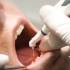 snimanje zuba povećava rizik od tumora mozga