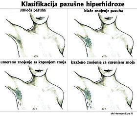 tabela znojenje ispod pazuha